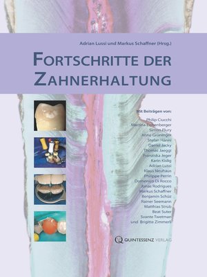 cover image of Fortschritte der Zahnerhaltung
